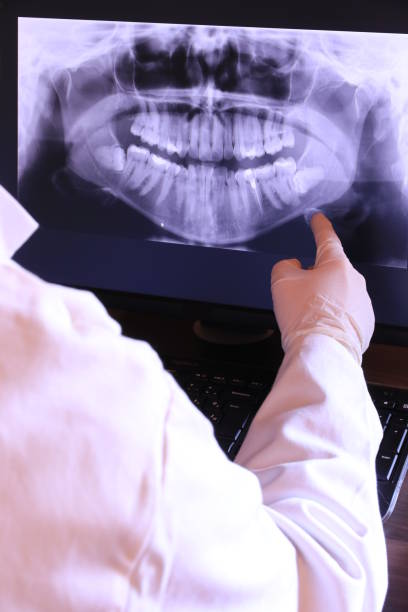 Teeth Whitening in IL